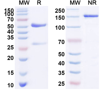 CD11a/ITGAL Rabbit Monoclonal Antibody