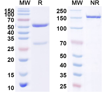 CD106/VCAM1 Rabbit Monoclonal Antibody