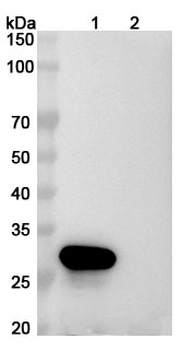 PMEL17/ME20M Mouse Monoclonal Antibody