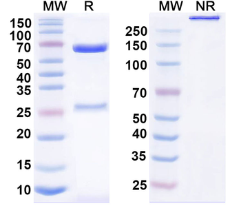 CD21/CR2 Mouse Monoclonal Antibody