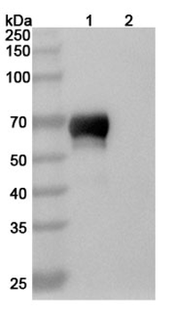 ROR1/NTRKR1 Mouse Monoclonal Antibody