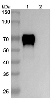 ROR1/NTRKR1 Mouse Monoclonal Antibody