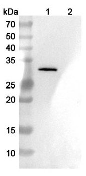 CCL5/RANTES Mouse Monoclonal Antibody