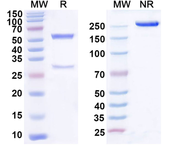 PDGFB Mouse Monoclonal Antibody