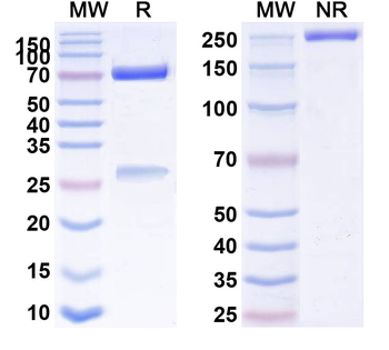 CD21/CD35 Mouse Monoclonal Antibody