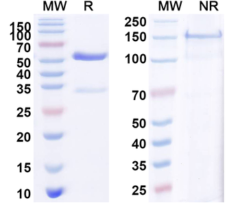 CD35/CR1/CD21b Rabbit Monoclonal Antibody