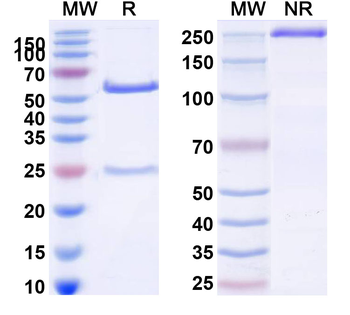 SIGLEC15/CD33L3 Human Monoclonal Antibody