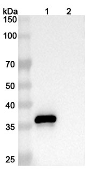 CD9 Human Monoclonal Antibody