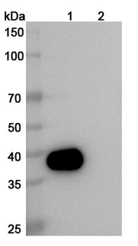 CD52 Mouse Monoclonal Antibody