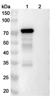 DSG3 Mouse Monoclonal Antibody