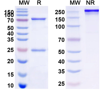 Perforin Mouse Monoclonal Antibody