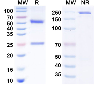 CXCL12/SDF-1 Human Monoclonal Antibody