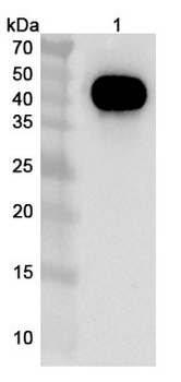 Zubotamig Chimeric Monoclonal Antibody