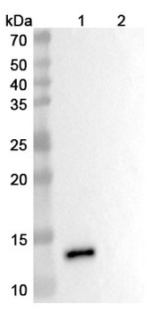 Adakitug Human Monoclonal Antibody