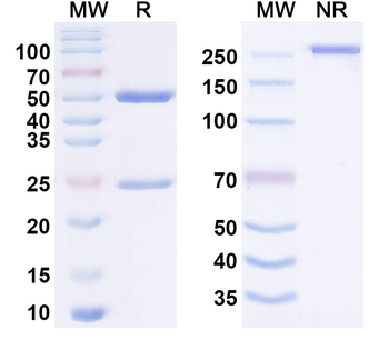 SARS-CoV-2 Spikeprotein (RBD) Human Monoclonal Antibody