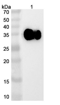 Xirestomig Human Monoclonal Antibody