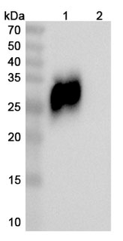 Fanastomig Chimeric Monoclonal Antibody
