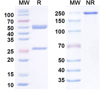 SARS-CoV-2 RBD Human Monoclonal Antibody