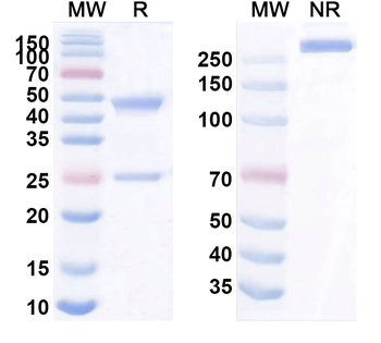 SIGLEC15/CD33L3 Human Monoclonal Antibody
