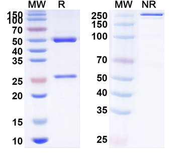 SIGLEC15/CD33L3 Human Monoclonal Antibody