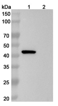 SERPINE1/PAI-1 Human Monoclonal Antibody