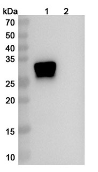 OSM/Oncostatin-M Human Monoclonal Antibody