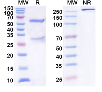 IL31 Human Monoclonal Antibody