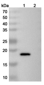IL21 Human Monoclonal Antibody