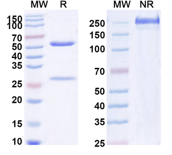 IL1B/IL1F2 Human Monoclonal Antibody