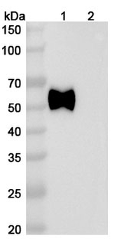 IL1RAP Human Monoclonal Antibody