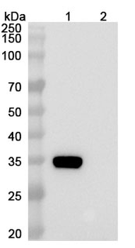 Prafnosbart Human Monoclonal Antibody