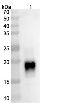 Ralzapastotug Human Monoclonal Antibody