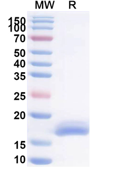 RSV F/Fusion glycoprotein F0 Monoclonal Antibody