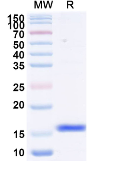 RSV F/Fusion glycoprotein F0 Monoclonal Antibody