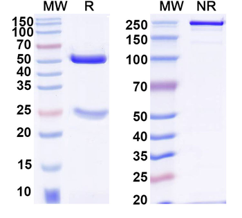 SARS-CoV-2 Spike Protein / RBD Human Monoclonal Antibody