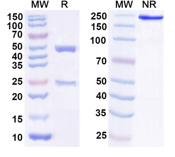IL25/IL17E Human Monoclonal Antibody