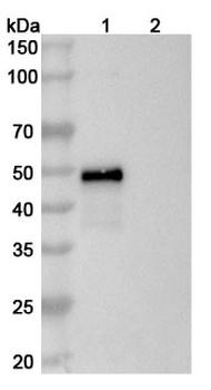 Risankizumab Human Monoclonal Antibody