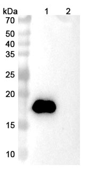 VAK-694 Human Monoclonal Antibody