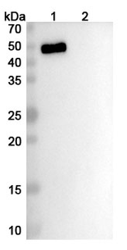 Ascrinvacumab Human Monoclonal Antibody