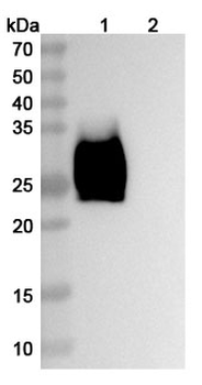 Ziralimumab Human Monoclonal Antibody