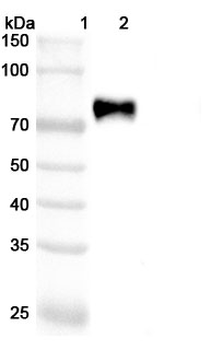 Vadastuximab Chimeric Monoclonal Antibody