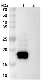 Epcoritamab Chimeric Monoclonal Antibody