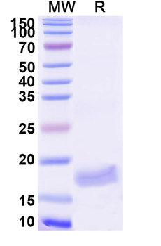 Zika Virus Envelope protein E Nanobody Antibody