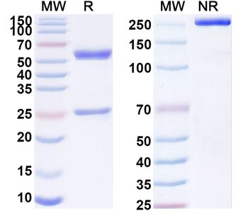 Hepatitis E virus/HEV E2s domain Antibody