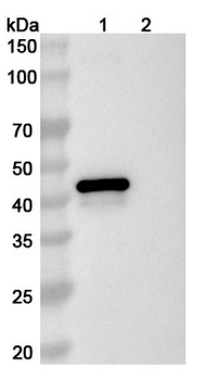 Recombinant BRSV Fusion Glycoprotein, N-His