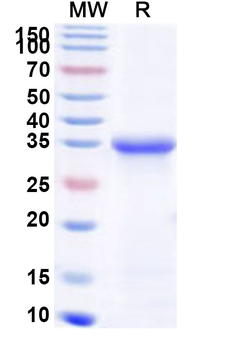 Human NTRK1 Recombinant Protein (N-His)