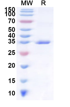 Recombinant Human IL23R Protein, N-His
