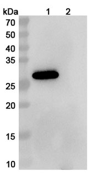 Human SLC34A2/NaPi2b Antibody