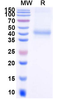 Recombinant Mouse CTSB Protein, C-His