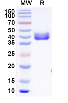 Recombinant Mouse CD112/Nectin-2/NECTIN2 Protein, C-His